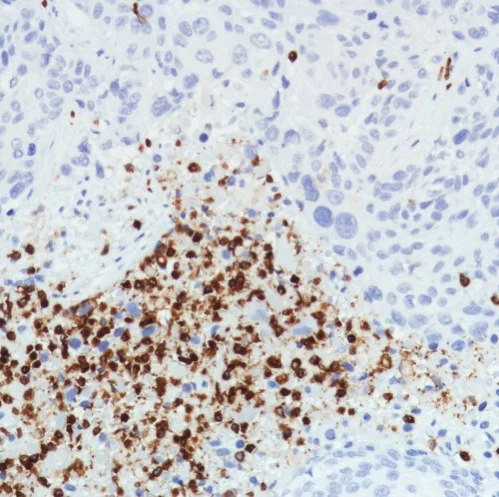 Immunohistochemistry (Formalin/PFA-fixed paraffin-embedded sections) - Anti-CD11b antibody [SP331] - BSA and Azide free (AB238794)