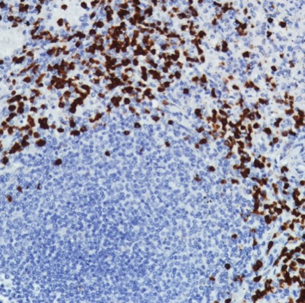 Immunohistochemistry (Formalin/PFA-fixed paraffin-embedded sections) - Anti-CD11b antibody [SP331] - BSA and Azide free (AB238794), expandable thumbnail