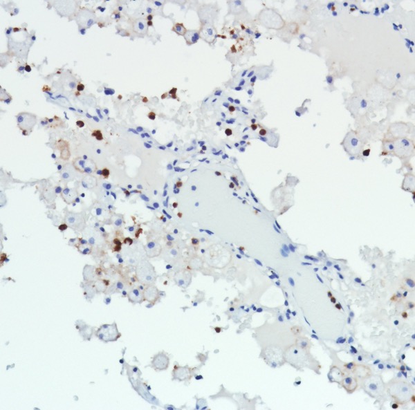 Immunohistochemistry (Formalin/PFA-fixed paraffin-embedded sections) - Anti-CD11b antibody [SP331] - BSA and Azide free (ab238794), expandable thumbnail