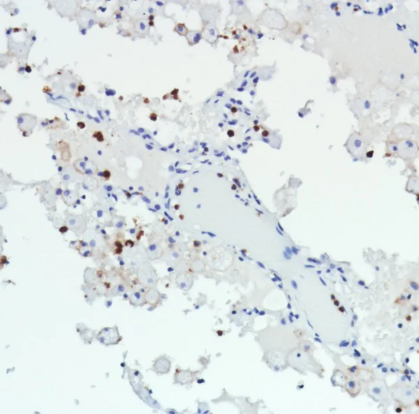 Immunohistochemistry (Formalin/PFA-fixed paraffin-embedded sections) - Anti-CD11b antibody [SP331] - BSA and Azide free (AB238794)