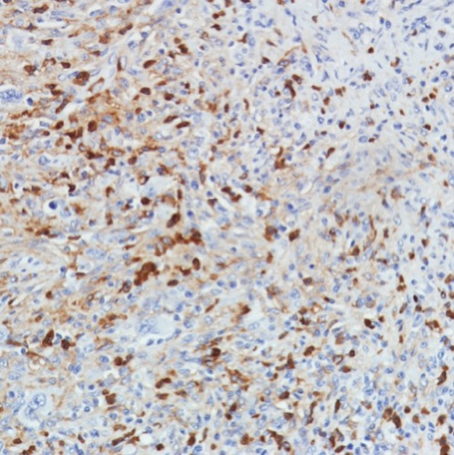 Immunohistochemistry (Formalin/PFA-fixed paraffin-embedded sections) - Anti-CD11b antibody [SP331] - BSA and Azide free (ab238794), expandable thumbnail
