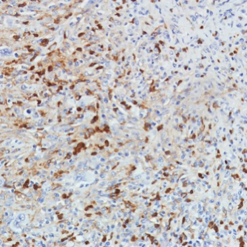Immunohistochemistry (Formalin/PFA-fixed paraffin-embedded sections) - Anti-CD11b antibody [SP331] - BSA and Azide free (AB238794)