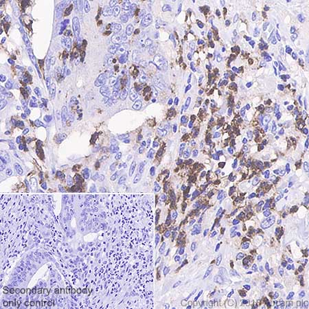 Immunohistochemistry (Formalin/PFA-fixed paraffin-embedded sections) - Anti-CD11b antibody [SP331] - BSA and Azide free (AB238794), expandable thumbnail