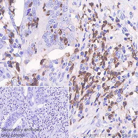 Immunohistochemistry (Formalin/PFA-fixed paraffin-embedded sections) - Anti-CD11b antibody [SP331] - BSA and Azide free (AB238794)