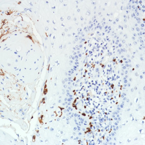 Immunohistochemistry (Formalin/PFA-fixed paraffin-embedded sections) - Anti-CD11b antibody [SP331] - BSA and Azide free (ab238794), expandable thumbnail