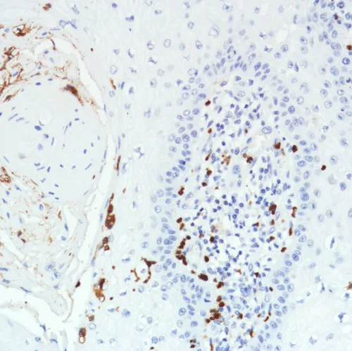 Immunohistochemistry (Formalin/PFA-fixed paraffin-embedded sections) - Anti-CD11b antibody [SP331] - BSA and Azide free (AB238794)