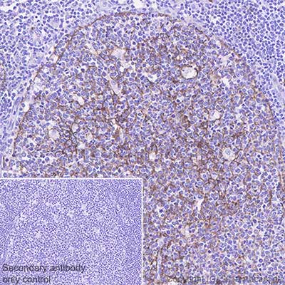 Immunohistochemistry (Formalin/PFA-fixed paraffin-embedded sections) - Anti-CD11b antibody [SP331] - BSA and Azide free (AB238794), expandable thumbnail