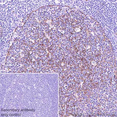 Immunohistochemistry (Formalin/PFA-fixed paraffin-embedded sections) - Anti-CD11b antibody [SP331] - BSA and Azide free (AB238794)