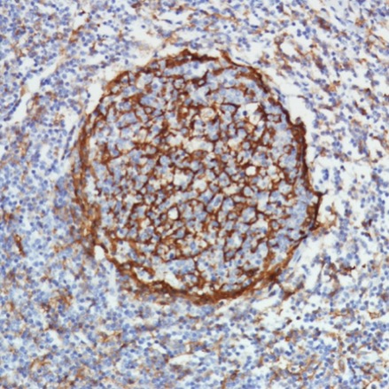 Immunohistochemistry (Formalin/PFA-fixed paraffin-embedded sections) - Anti-CD11b antibody [SP331] - BSA and Azide free (AB238794), expandable thumbnail