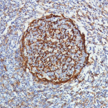 Immunohistochemistry (Formalin/PFA-fixed paraffin-embedded sections) - Anti-CD11b antibody [SP331] - BSA and Azide free (AB238794)