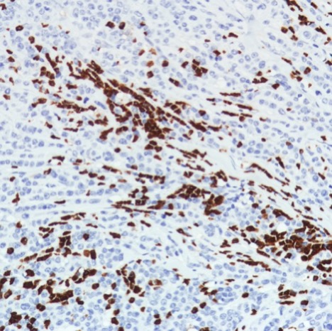 Immunohistochemistry (Formalin/PFA-fixed paraffin-embedded sections) - Anti-CD11b antibody [SP331] - BSA and Azide free (ab238794), expandable thumbnail