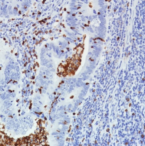 Immunohistochemistry (Formalin/PFA-fixed paraffin-embedded sections) - Anti-CD11b antibody [SP331] - BSA and Azide free (ab238794), expandable thumbnail