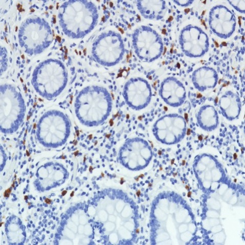 Immunohistochemistry (Formalin/PFA-fixed paraffin-embedded sections) - Anti-CD11b antibody [SP331] - BSA and Azide free (AB238794), expandable thumbnail