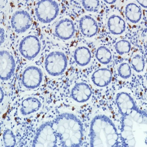 Immunohistochemistry (Formalin/PFA-fixed paraffin-embedded sections) - Anti-CD11b antibody [SP331] - BSA and Azide free (AB238794)
