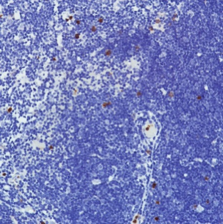 Immunohistochemistry (Formalin/PFA-fixed paraffin-embedded sections) - Anti-CD11b antibody [SP331] - BSA and Azide free (ab238794), expandable thumbnail