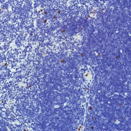 Immunohistochemistry (Formalin/PFA-fixed paraffin-embedded sections) - Anti-CD11b antibody [SP331] - BSA and Azide free (AB238794)