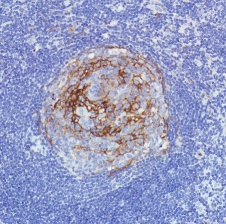 Immunohistochemistry (Formalin/PFA-fixed paraffin-embedded sections) - Anti-CD11b antibody [SP331] - BSA and Azide free (ab238794), expandable thumbnail