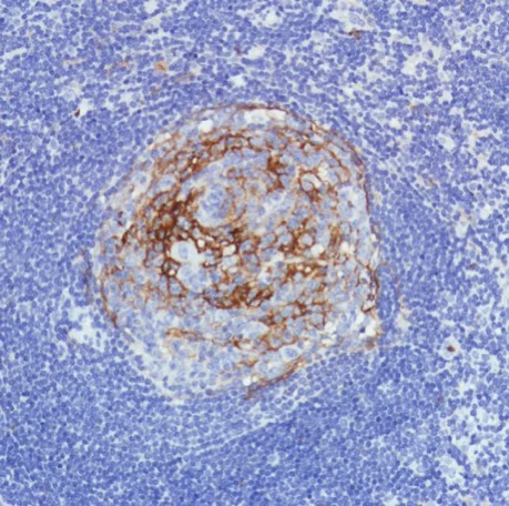 Immunohistochemistry (Formalin/PFA-fixed paraffin-embedded sections) - Anti-CD11b antibody [SP331] - BSA and Azide free (AB238794)