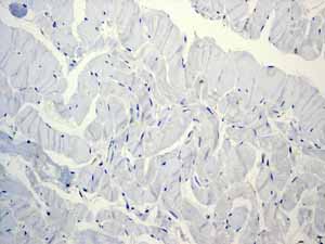 Immunohistochemistry (Formalin/PFA-fixed paraffin-embedded sections) - Anti-CD11c antibody [EP1347Y] - BSA and Azide free (AB216655), expandable thumbnail
