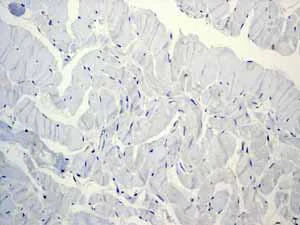 Immunohistochemistry (Formalin/PFA-fixed paraffin-embedded sections) - Anti-CD11c antibody [EP1347Y] - BSA and Azide free (AB216655)