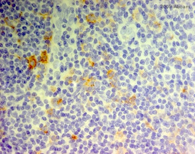 Immunohistochemistry (Formalin/PFA-fixed paraffin-embedded sections) - Anti-CD11c antibody [EP1347Y] - BSA and Azide free (AB216655), expandable thumbnail