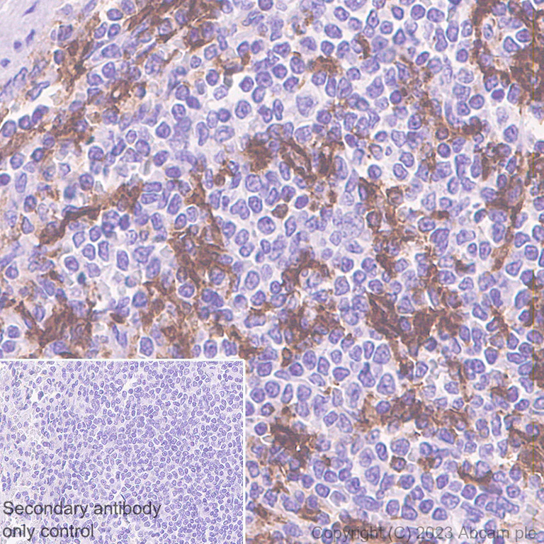 Immunohistochemistry (Formalin/PFA-fixed paraffin-embedded sections) - Anti-CD11c antibody [EP1347Y] - BSA and Azide free (AB216655)