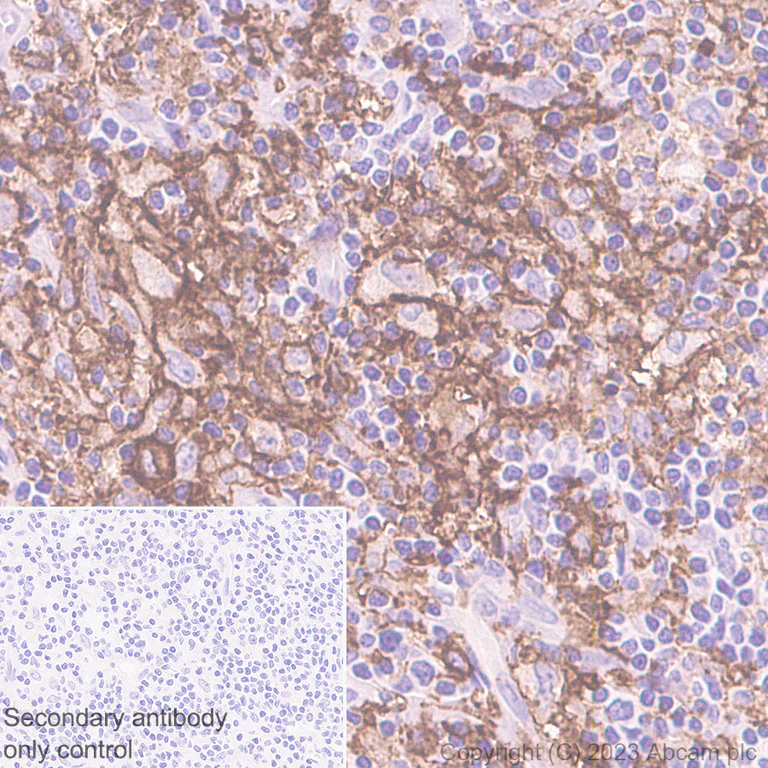 Immunohistochemistry (Formalin/PFA-fixed paraffin-embedded sections) - Anti-CD11c antibody [EP1347Y] - BSA and Azide free (AB216655)