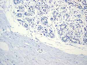 Immunohistochemistry (Formalin/PFA-fixed paraffin-embedded sections) - Anti-CD11c antibody [EP1347Y] - BSA and Azide free (AB216655), expandable thumbnail