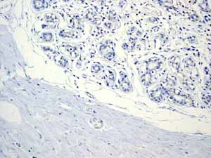 Immunohistochemistry (Formalin/PFA-fixed paraffin-embedded sections) - Anti-CD11c antibody [EP1347Y] - BSA and Azide free (AB216655)