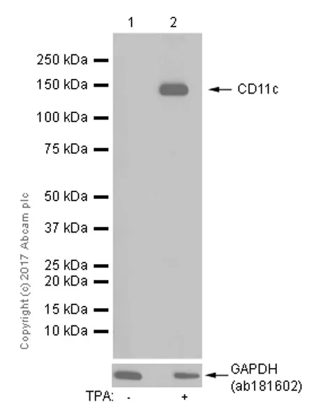 Western blot - Anti-CD11c antibody [EP1347Y] - BSA and Azide free (AB216655)