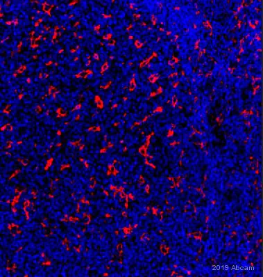 Immunohistochemistry (Formalin/PFA-fixed paraffin-embedded sections) - Anti-CD11c antibody [EP1347Y] - C-terminal (AB52632)
