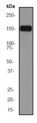 Western blot - Anti-CD11c antibody [EP1347Y] - C-terminal (AB52632)