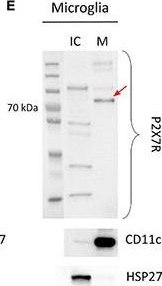 Western blot - Anti-CD11c antibody [EP1347Y] - C-terminal (ab52632), expandable thumbnail