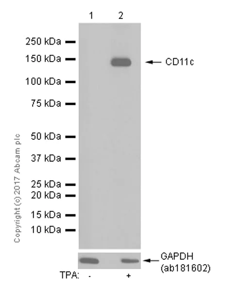 Western blot - Anti-CD11c antibody [EP1347Y] - C-terminal (AB52632)