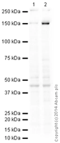 Western blot - Anti-CD11c antibody [EP1347Y] - C-terminal (AB52632)