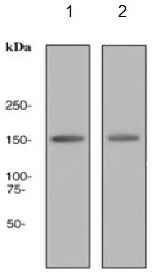 Western blot - Anti-CD11c antibody [EPR1346] (AB133246), expandable thumbnail