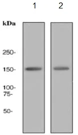 Western blot - Anti-CD11c antibody [EPR1346] (AB133246)