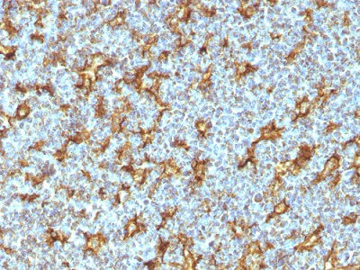 Immunohistochemistry (Formalin/PFA-fixed paraffin-embedded sections) - Anti-CD11c antibody [ITGAX/1242] - BSA and Azide free (AB212508)