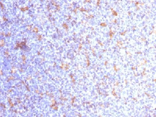 Immunohistochemistry (Formalin/PFA-fixed paraffin-embedded sections) - Anti-CD11c antibody [ITGAX/1284] (AB218434), expandable thumbnail