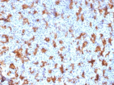Immunohistochemistry (Formalin/PFA-fixed paraffin-embedded sections) - Anti-CD11c antibody [ITGAX/2507] - BSA and Azide free (AB237856)