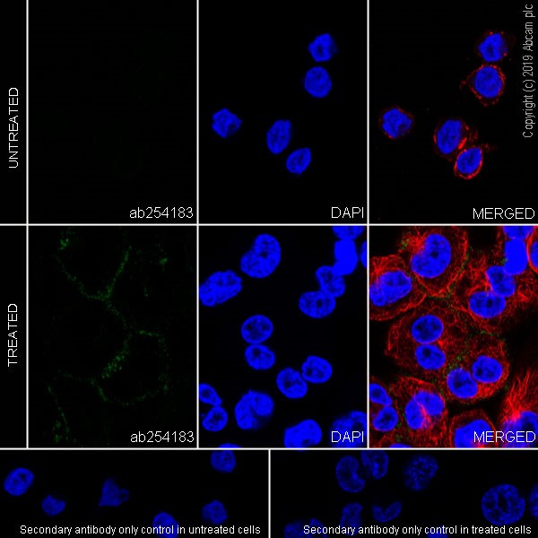 Immunocytochemistry - Anti-CD11c antibody [KB90] (AB254183), expandable thumbnail