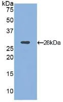 Western blot - Anti-CD11d antibody (AB231534)