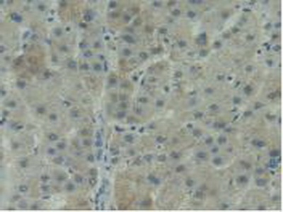 Immunohistochemistry (Formalin/PFA-fixed paraffin-embedded sections) - Anti-CD11d antibody (AB231622), expandable thumbnail