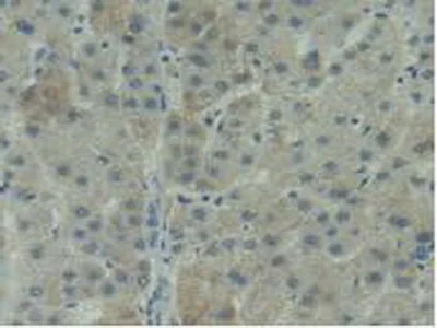 Immunohistochemistry (Formalin/PFA-fixed paraffin-embedded sections) - Anti-CD11d antibody (AB231622)