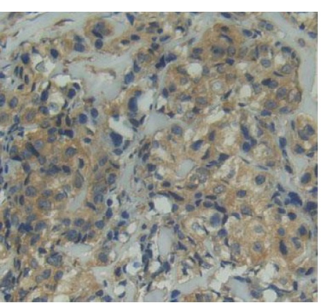 Immunohistochemistry (Formalin/PFA-fixed paraffin-embedded sections) - Anti-CD11d antibody (AB231622), expandable thumbnail