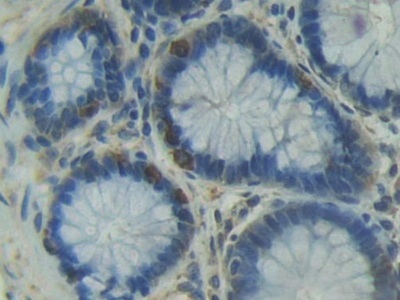 Immunohistochemistry (Formalin/PFA-fixed paraffin-embedded sections) - Anti-CD11d antibody (AB231622), expandable thumbnail