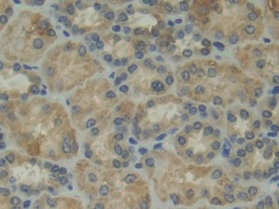 Immunohistochemistry (Formalin/PFA-fixed paraffin-embedded sections) - Anti-CD11d antibody (AB231622), expandable thumbnail