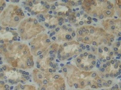 Immunohistochemistry (Formalin/PFA-fixed paraffin-embedded sections) - Anti-CD11d antibody (AB231622)