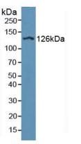 Western blot - Anti-CD11d antibody (AB231622), expandable thumbnail