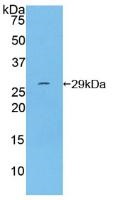 Western blot - Anti-CD11d antibody (ab231622), expandable thumbnail